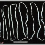 【閲覧注意】十年くらい前、排便中にサナダ虫が。白い紐状の物体がにゅるにゅると。家族には誰も言えないまま、翌日学校休んで病院へ行ったら……