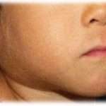 【修羅場】妊娠中、流産の危険ありで入院してたんだけど、そのタイミングで長男と次男がおたふくかぜに感染、したと思ったら夫も？！でもまぁまだ余裕があったんだ。このときまでは。そこから更に？！そして更に？？！でパニックになった私はとんでもない言い間違いを犯して私の実家までパニックに？！