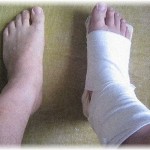 【嫌な上司】上司が骨折したので車で送迎することになった。運転中、いちいち横から口を出してくるので憂鬱になってきたころ・・・