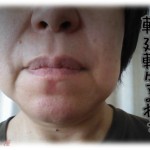 【最低な姑】普段から、事故や病気で体が不自由な人に対してナチュラルに差別するモラハラ姑。私に子供が生まれた時、先天性の遺伝障害が判明し、大姑の米寿の時にみんなに報告したら姑が発狂した。散々罵倒され涙ながらに「両親共に因子を持ってないと出ない」と説明したが他の男の子供だとまで言われた。そしたら大姑がポツリと…。