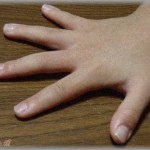 【子育て相談】保育園から私と旦那へ呼び出しが。今までも爪を切ってきてと指摘が何度かあった。