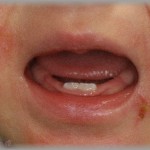 【エネ夫】犬アレルギーの私に「我慢すれば？」と犬を飼い続けた旦那。とうとう子供にもひどい犬アレルギーが出て、追い詰められた私はとんでもないことをしてしまった・・・！