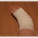 【策士】数年前、小姑の車にひかれて大怪我を負ったとき、警察沙汰にしたことに腹を立てた姑にいびられた。先日姑が階段から落ちて骨折した際、私に介護させるような発言をしたので言ってやった。といっても普通に聞いたらいい嫁な発言なんだけどなぁｗｗ