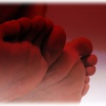 【修羅場】足のうおのめが悪化した結果→医者「あーこれ足切断かな」私「切断はいやぁぁぁ！」。結局…。