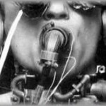 【酷い】Ａ母の病気の治療方針はどんどん強い薬に切り替えていくものだった。人工呼吸器を付けているので息がとまることはない・・・が・・・