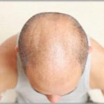 【予測不能】父方家系には男は30歳になるとハゲるというジンクスがある。祖父＆父「お前も覚悟しておけ」→学生時代から涙ぐましい努力をした結果、とんでもないことに・・・