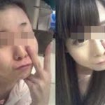 【修羅場】私たち双子姉妹は、二人揃って芸名のようなお嬢様風の名前。でも、私はムッシュかまやつ似、妹は假屋崎省吾似のブス姉妹。妹は美容の学校に進み、割と美人になった。そんな妹が結婚することになったんだけど、式で私の顔を見た新郎親族が「おかしい！新婦は整形だ！」と騒ぎだし・・・