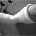 【修羅場】小学校の時に階段から転げ落ちて大怪我し、しばらく入院した。その事故から７年後にクソ教師と出会ってしまい・・・