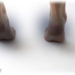 【衝撃体験】左足の踵がなんか痛いが、ブラック企業勤めだったこともありスルーしてた。久々のストレッチ中に踵を見ると毛が刺さってたので抜いてみると…