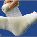 【人の振り見て…】バイクに足の甲を踏まれて骨が折れた。ギプスのまま出勤したらみんな気遣ってくれたのに、同僚の1人が「たかが骨折で大げさ」と嫌味に接してしてくる！