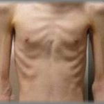 【弟嫁】弟が倒れたと聞いて病院に駆けつけると、そこには見る影もなくやせ細った弟の姿が・・・「ひどい栄養失調です」という医者の言葉に唖然としてると、そこに丸々と太った弟嫁がやってきて・・・