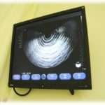 【DQN返し】現在妊娠7ヶ月。夫実家は子供の性別を知りたがり、私実家は生まれてからの楽しみにしたいと言われていた。あまりにも夫実家がしつこいので