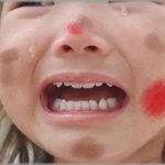 【衝撃体験】前妻と北海道に住んでる小学生の娘が、いきなり東京の俺の家に来た。見ると全身切り傷と痣だらけ・・・